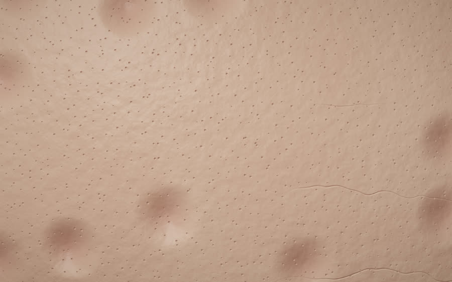 Før: Microneedling (3D-illustration – ikke et rigtigt kundefoto)